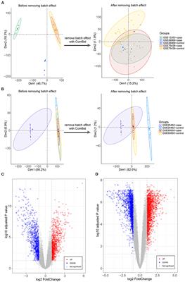 Analysis of co-expression gene network associated with intracranial aneurysm and type 2 diabetes mellitus